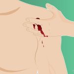 How to Treat a Bullet Wound