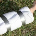 Dealing With Sprains and Broken Bones in the Field