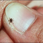Simple Steps for Tick Protection